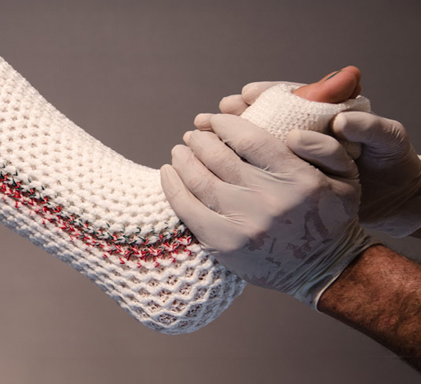 גרל שבור עם גבס קל